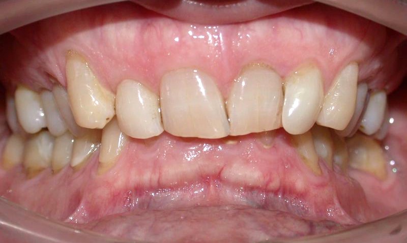 Problème esthétique