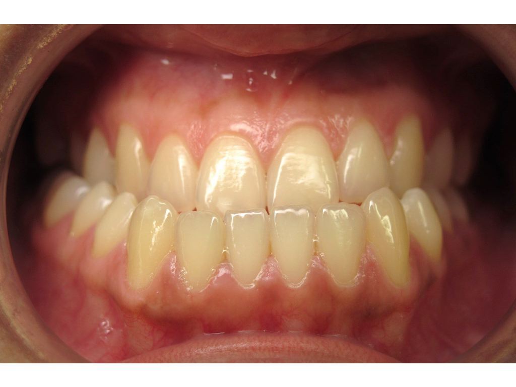 Problème chirurgical