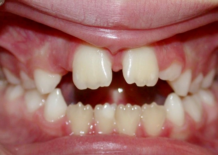 Problème fonctionnel